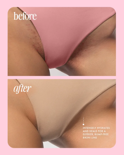 ⚡️ 5-Second Post-Hair Removal Rescue: Bumps Fade, Skin Glows! Glass Smooth Oil.⚡️Limited-Time Surprise Offer · Exclusive Perks for the First 300 Orders⚡️